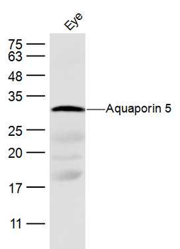Aquaporin 5 Rabbit Polyclonal Antibody