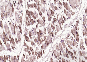 AMPK beta 1/PRKAB1 Rabbit Polyclonal Antibody