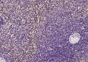 AMPK beta 1/PRKAB1 Rabbit Polyclonal Antibody