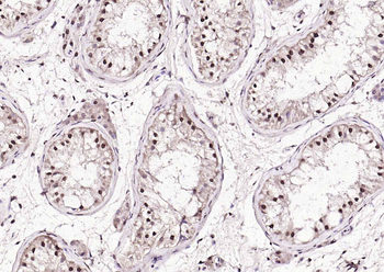 AMPK beta 1/PRKAB1 Rabbit Polyclonal Antibody