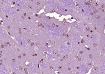 AMPK beta 1/PRKAB1 Rabbit Polyclonal Antibody