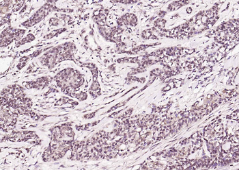 AMPK beta 1/PRKAB1 Rabbit Polyclonal Antibody