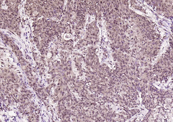 AMPK beta 1/PRKAB1 Rabbit Polyclonal Antibody