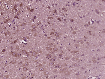 ATP6V1G2 Rabbit Polyclonal Antibody