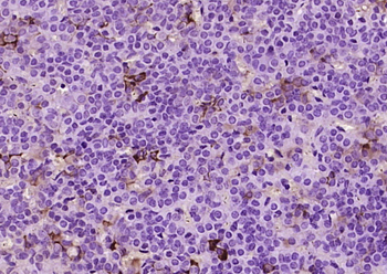 Beta endorphin Rabbit Polyclonal Antibody