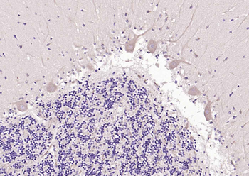 Beta arrestin 1 Rabbit Polyclonal Antibody