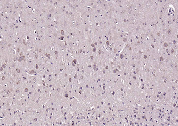 Beta arrestin 1 Rabbit Polyclonal Antibody