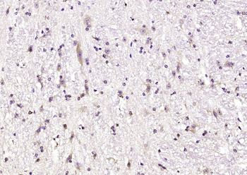 Beta arrestin 1 Rabbit Polyclonal Antibody
