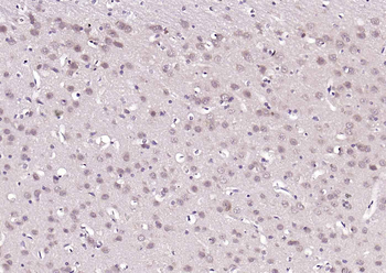 Beta arrestin 1 Rabbit Polyclonal Antibody