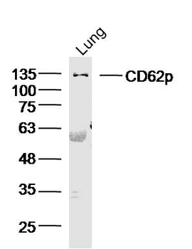 CD62p Rabbit Polyclonal Antibody