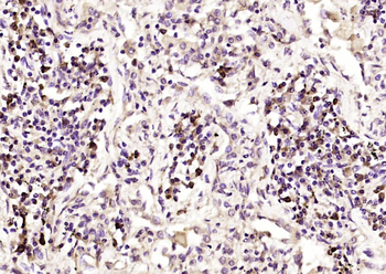 CTR1 Rabbit Polyclonal Antibody