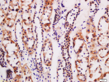 CTR1 Rabbit Polyclonal Antibody