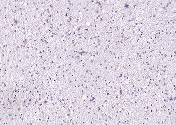 Phospho-CDK9 (Thr29) Rabbit Polyclonal Antibody