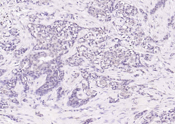 Phospho-CDK9 (Thr29) Rabbit Polyclonal Antibody