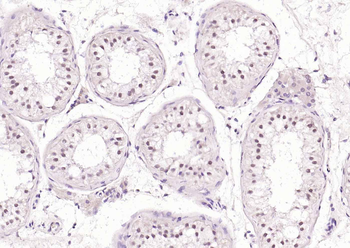 Phospho-CDK9 (Thr29) Rabbit Polyclonal Antibody