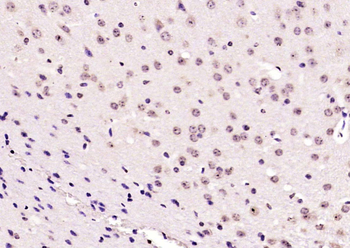 Phospho-CDK9 (Thr29) Rabbit Polyclonal Antibody