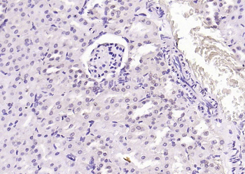 Phospho-CDK9 (Thr29) Rabbit Polyclonal Antibody