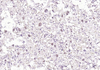 Phospho-CDK9 (Thr29) Rabbit Polyclonal Antibody