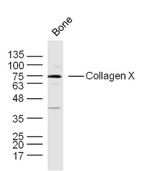 Collagen X Rabbit Polyclonal Antibody