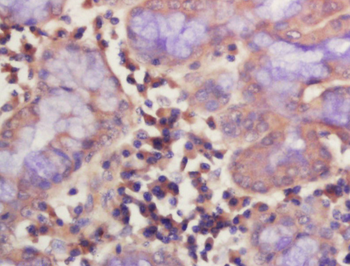 DARC Rabbit Polyclonal Antibody