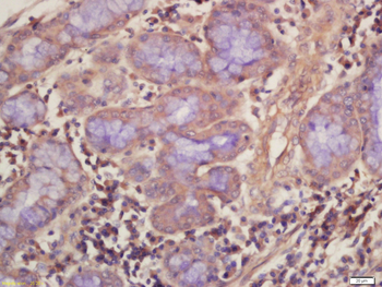 DARC Rabbit Polyclonal Antibody