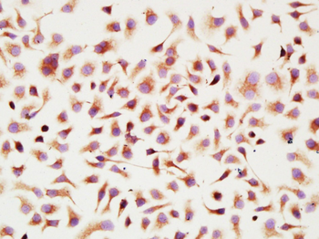 Fibronectin/Ugl-Y3 Rabbit Polyclonal Antibody