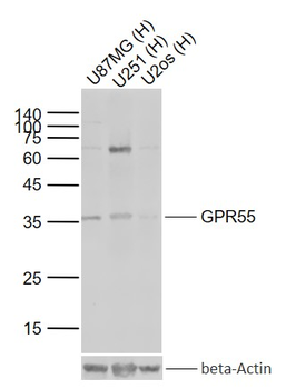 GPR55 Rabbit Polyclonal Antibody