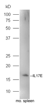 IL17E Rabbit Polyclonal Antibody