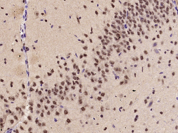 KLF2 Rabbit Polyclonal Antibody