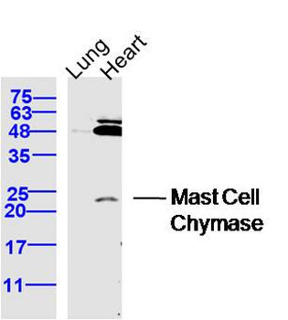 CMA1 Rabbit Polyclonal Antibody