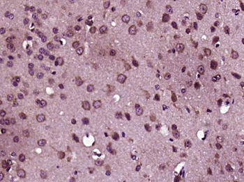 MIA3 Rabbit Polyclonal Antibody