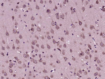 MIA3 Rabbit Polyclonal Antibody