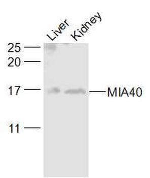 MIA40 Rabbit Polyclonal Antibody