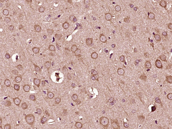 MICALL2/JRAB Rabbit Polyclonal Antibody