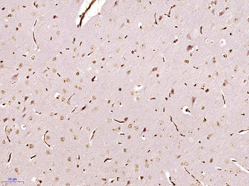 MONDOA Rabbit Polyclonal Antibody
