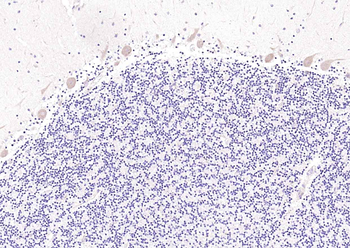 MXRA8 Rabbit Polyclonal Antibody