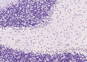 MXRA8 Rabbit Polyclonal Antibody