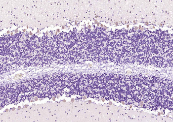 MXRA8 Rabbit Polyclonal Antibody