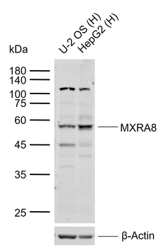 MXRA8 Rabbit Polyclonal Antibody