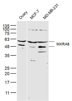 MXRA8 Rabbit Polyclonal Antibody
