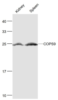 COPS9 Rabbit Polyclonal Antibody