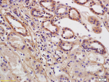 MRCK alpha Rabbit Polyclonal Antibody