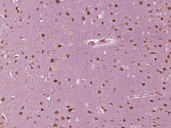 Musashi 1 Rabbit Polyclonal Antibody