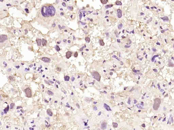 NUP88 Rabbit Polyclonal Antibody