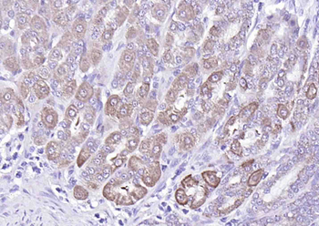 N ras + c Ha ras Rabbit Polyclonal Antibody