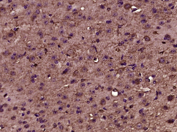 Phospho-N WASP (Tyr256) Rabbit Polyclonal Antibody
