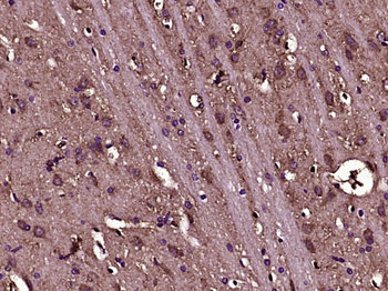 Phospho-N WASP (Tyr256) Rabbit Polyclonal Antibody