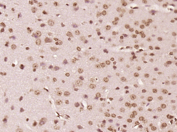 Nance-Horan Syndrome Protein Rabbit Polyclonal Antibody