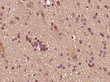 NAP1L4 Rabbit Polyclonal Antibody