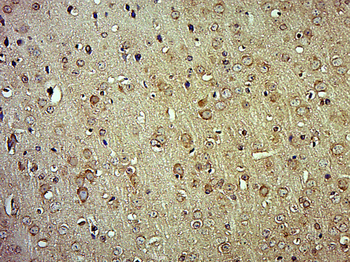 NAPG Rabbit Polyclonal Antibody
